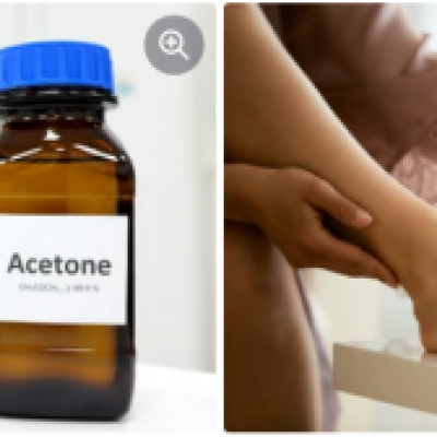 Acetone manufacturers, exporters, and suppliers in canada